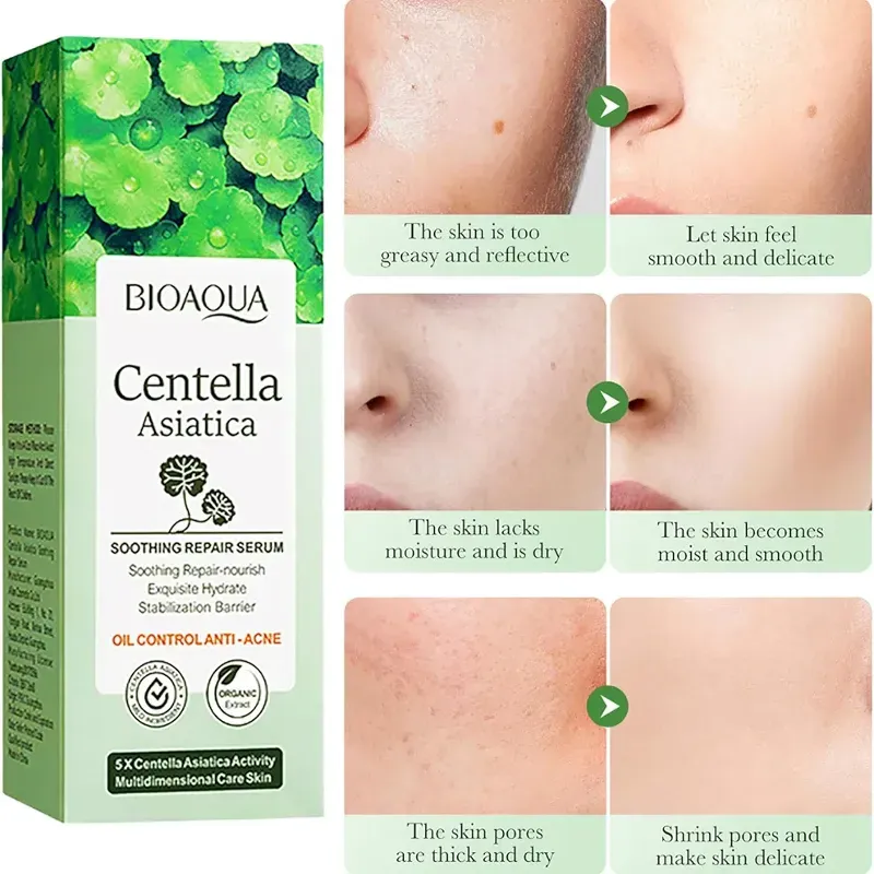 Serum facial Centella Asiática