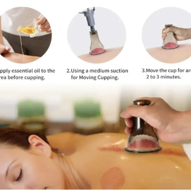 Kit de ventosas para terapia de masaje