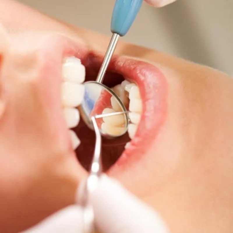 Otros Servicios Dentales