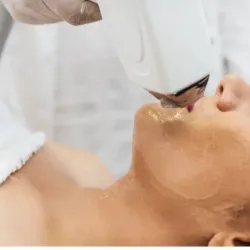 Bozo/Labio Superiror ✨️