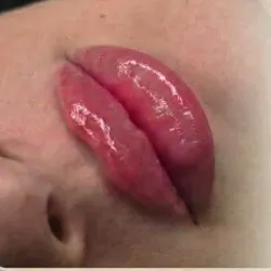 💋 Filler Lips (cc)
