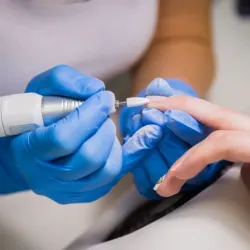 💅 Remoción de Uñas