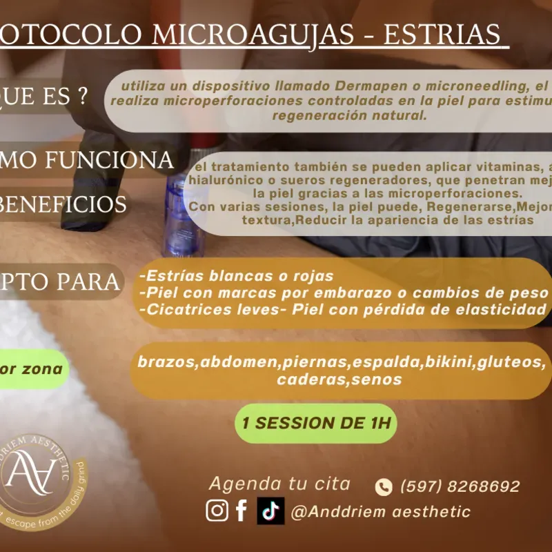 Dermapen para Estrías Corporales