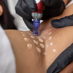 BB GLOW  FACIAL O CORPORAL