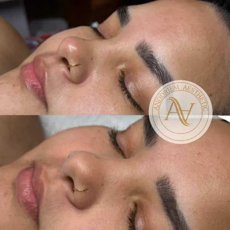 Hidratación Facial y Corporal 