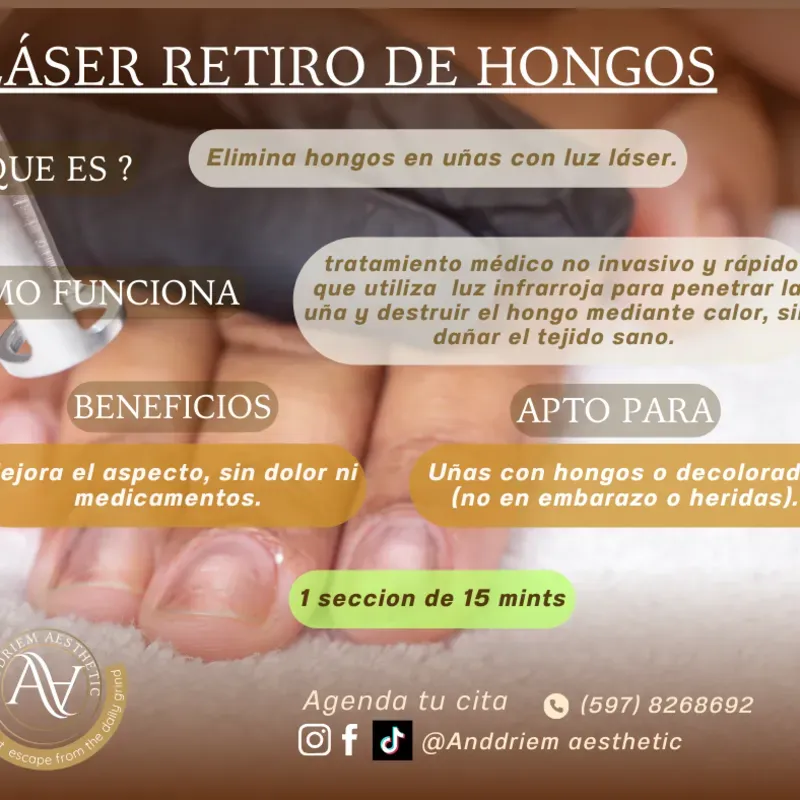RETIRO DE HONGO EN LAS UNAS 