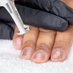 RETIRO DE HONGO EN LAS UNAS 