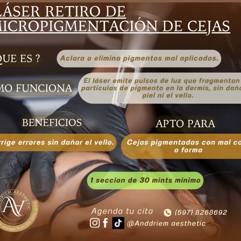 Láser Retiro de Micropigmentación 