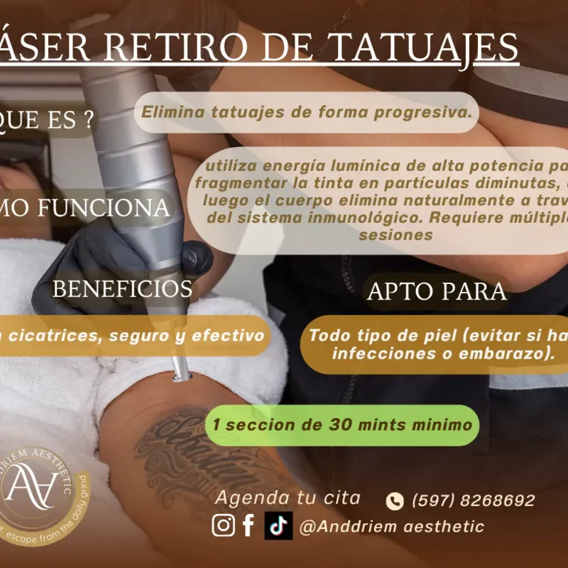 Láser Retiro de Tatuajes