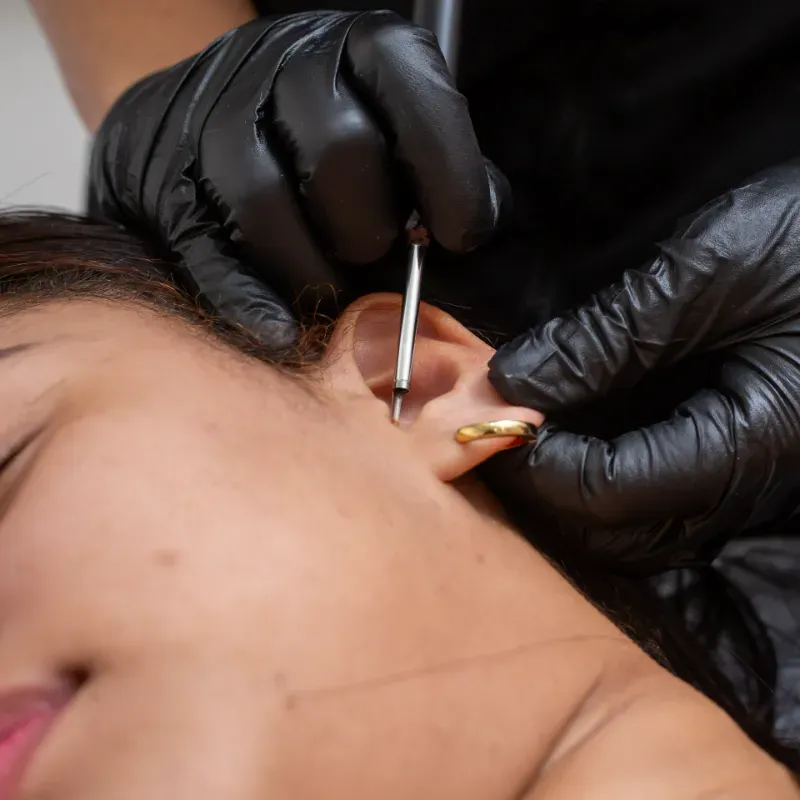 Limpieza de Oído con Máquina de Agua