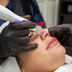 PROTOCOLO DE HIDRATACION Y EXTRACION DE COMEDONES 