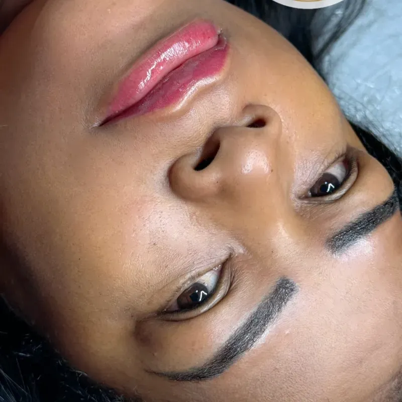 Neutralizacion  retoque de otros trabajos 