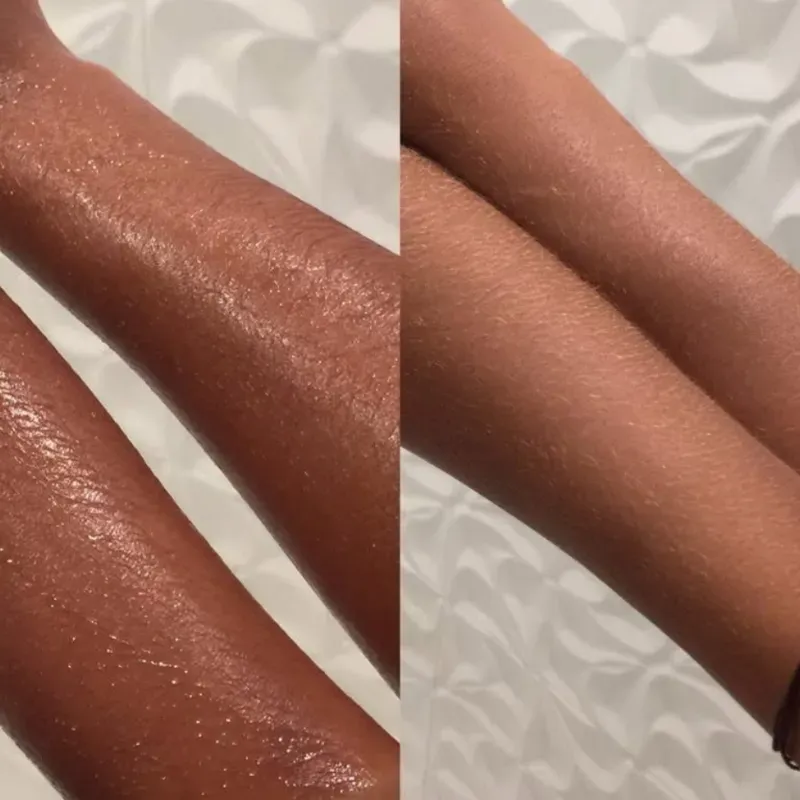 Terapia Baño de Lua