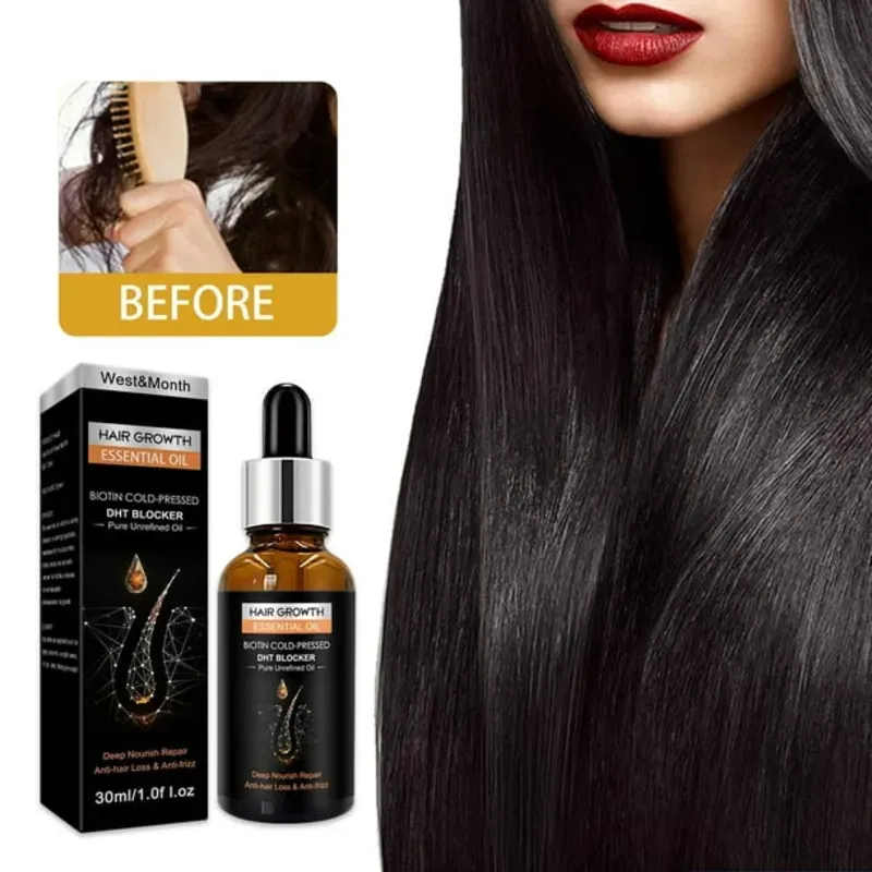 ✨ Aceite esencial para el crecimiento del cabello con biotina prensada en frío y bloqueador de DHT