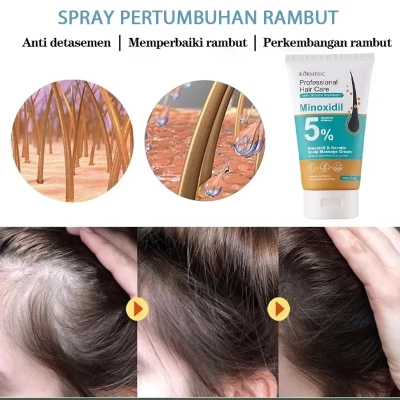 Crema de Minoxidil con Keratina 