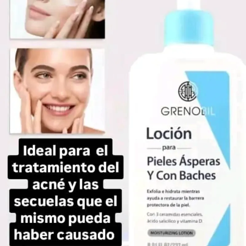 Loción para Pieles Ásperas y con Baches.