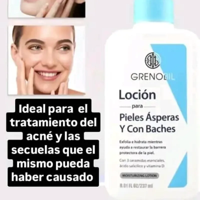 Loción para Pieles Ásperas y con Baches.