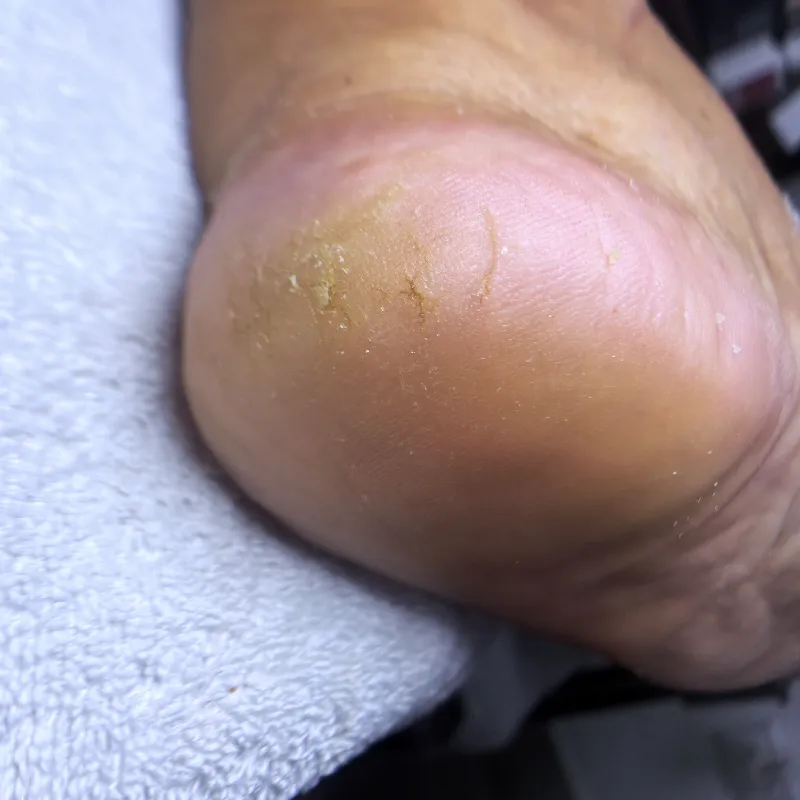 Pedicura spa profunda 