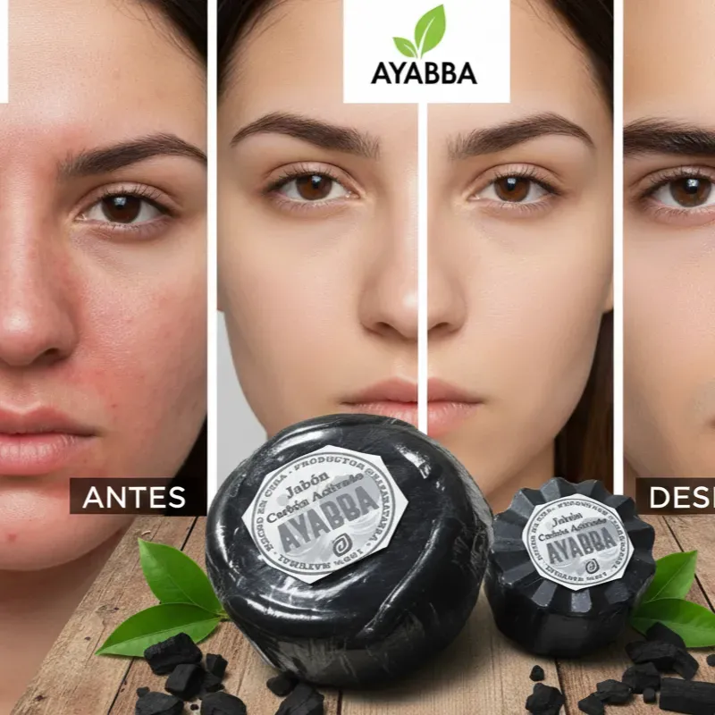 Jabón de Carbón Activado 