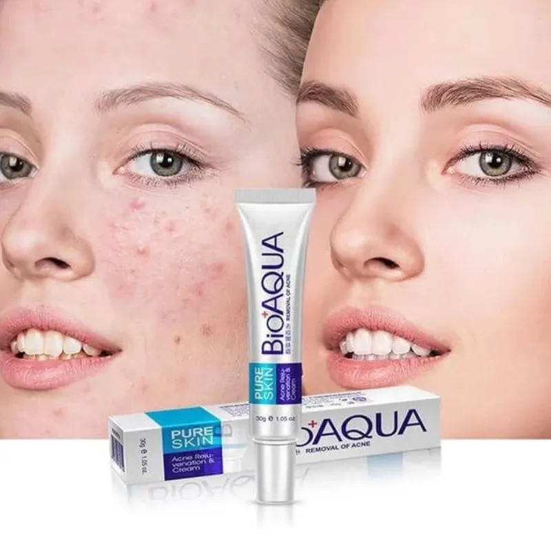 Loción para Acné Pure Skin