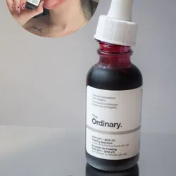 Peeling Solution de Ordinary