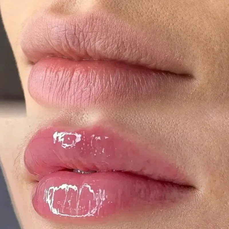 Spa labial  (10 min ).
