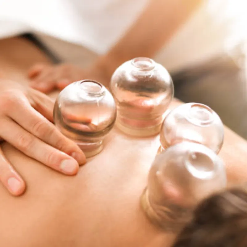 Terapia con ventosas 