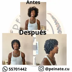 Definición de rizos 