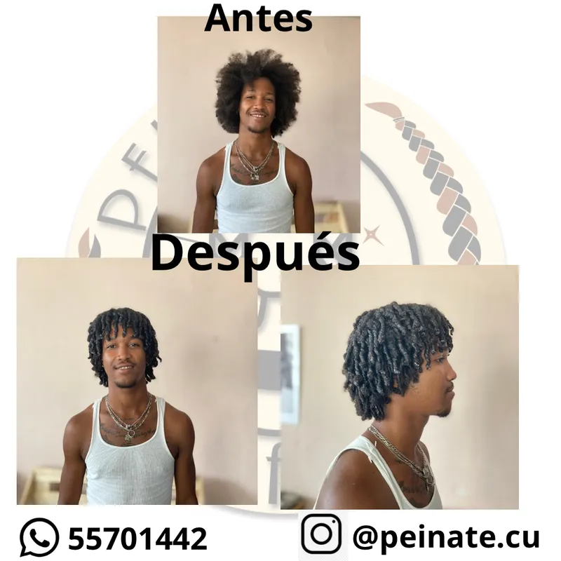 Definición de rizos 