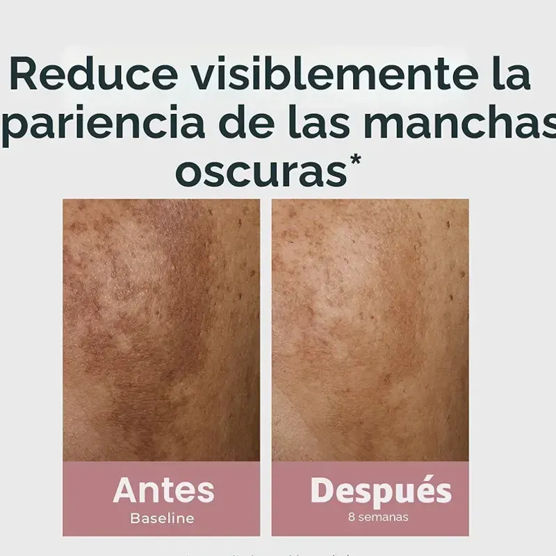 Eucerin Radiant Tone Dual Serum