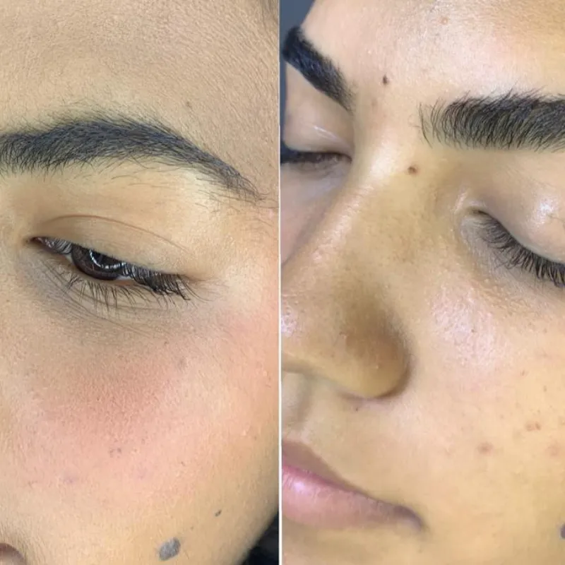 Depilación de cejas con cera