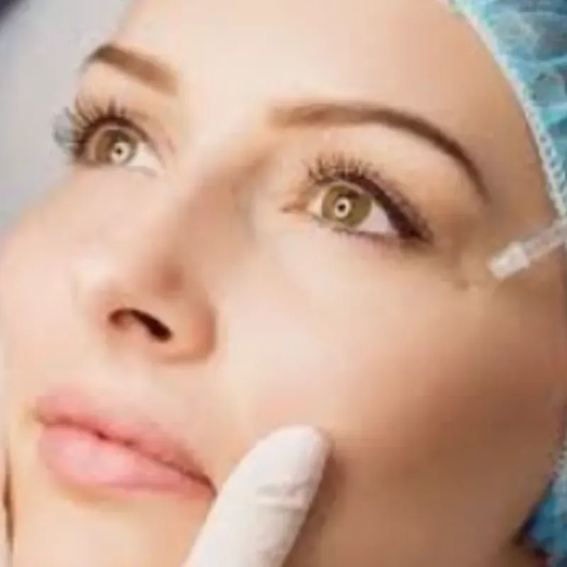 Botox (Toxina Botulínica Tipo A)