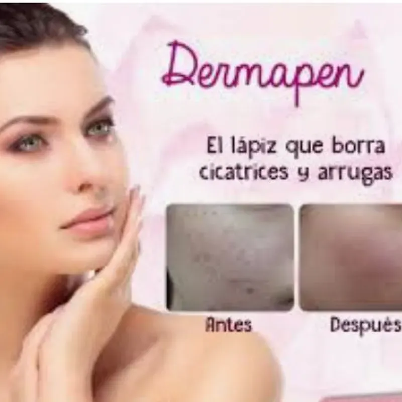 Dermapen facial o Micronnedling