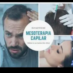 Mesoterapia capilar