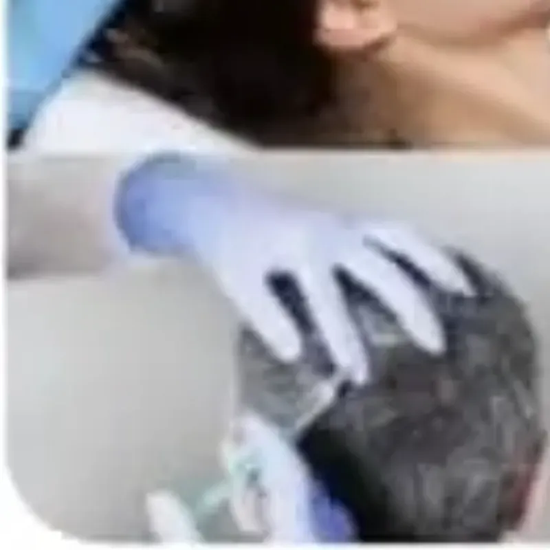 Tratamiento para la alopecia