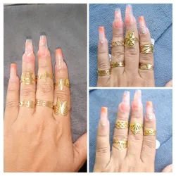 Anillos de acero quirúrgico