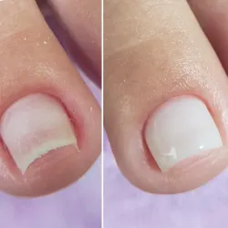 Gel Polish 