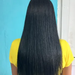 Cirugia Capilar
