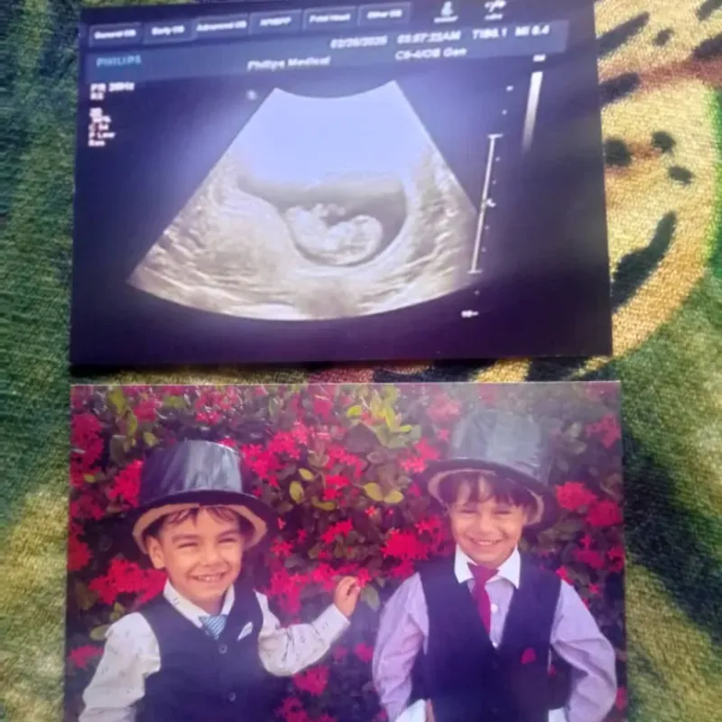 Fotos