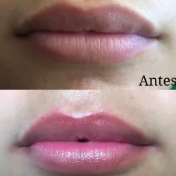BB Lips Semi-Permanent