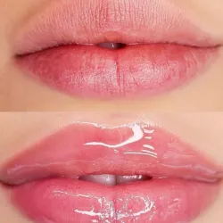 Hydra Lips Premium