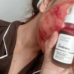 The Ordinary Peeling Solution 
