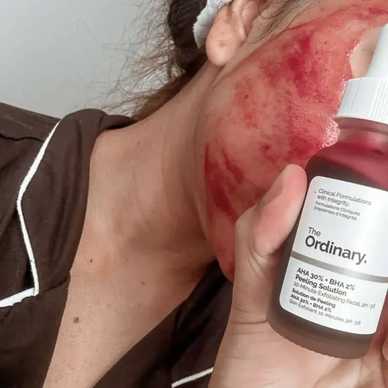 The Ordinary Peeling Solution 
