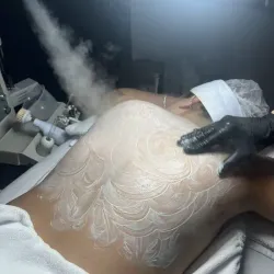 Limpieza profunda de espalda