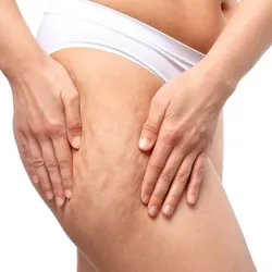 Crema para la celulitis