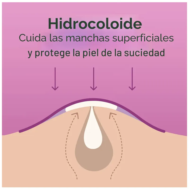 Parches Hidrocoloides para Acné