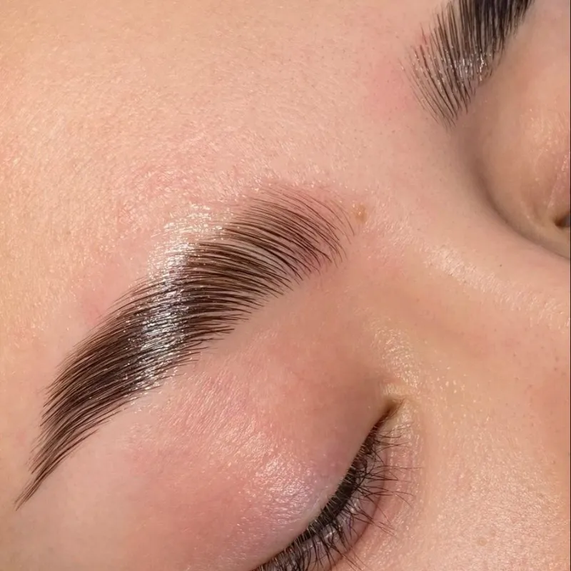 Lifting de cejas 