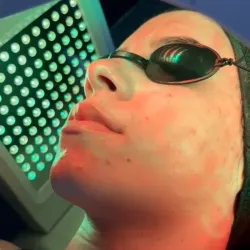 Limpieza Facial Profunda 