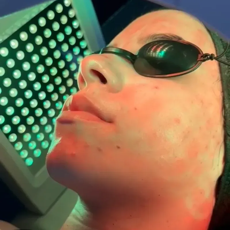 Limpieza Facial Profunda