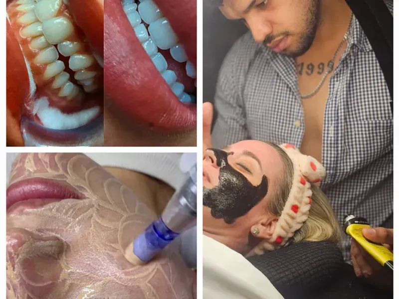 APARATOLOGIA FACIAL Y TRATAMIENTOS DE HIDRATACIÓN 💋🌹